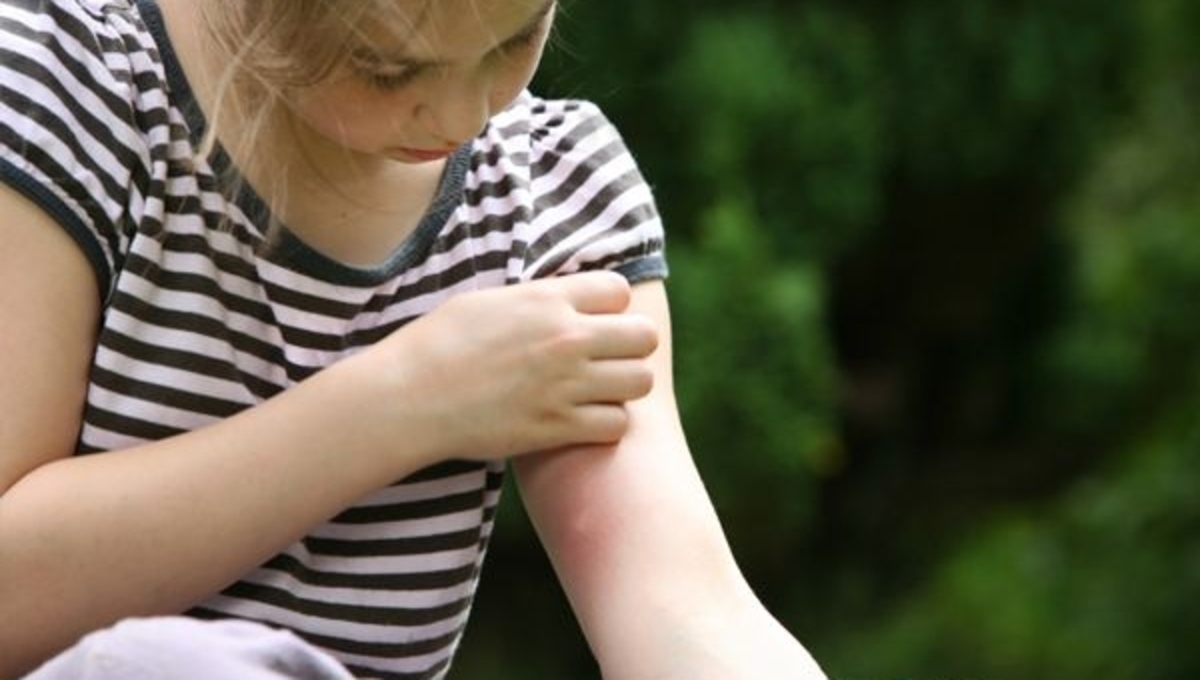 Πώς να προστατεύσετε τα παιδιά από τα κουνούπια