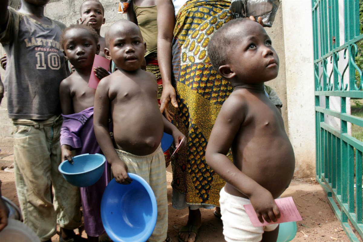 Εκατομμύρια παιδιά θα εμφανίσουν καθυστέρηση στην ανάπτυξη εξαιτίας του υποσιτισμού, σύμφωνα με την UNICEF