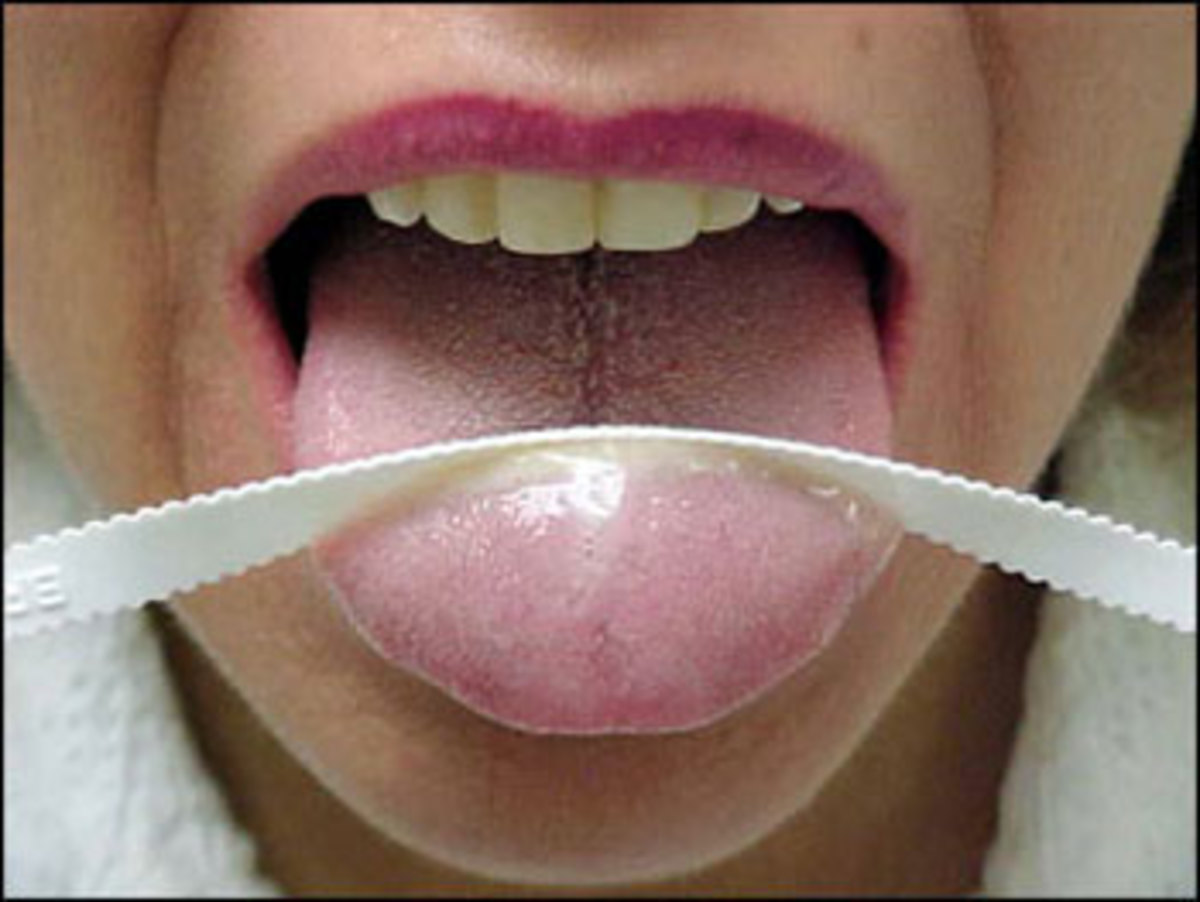 Τροφές και κακοσμία στόματος