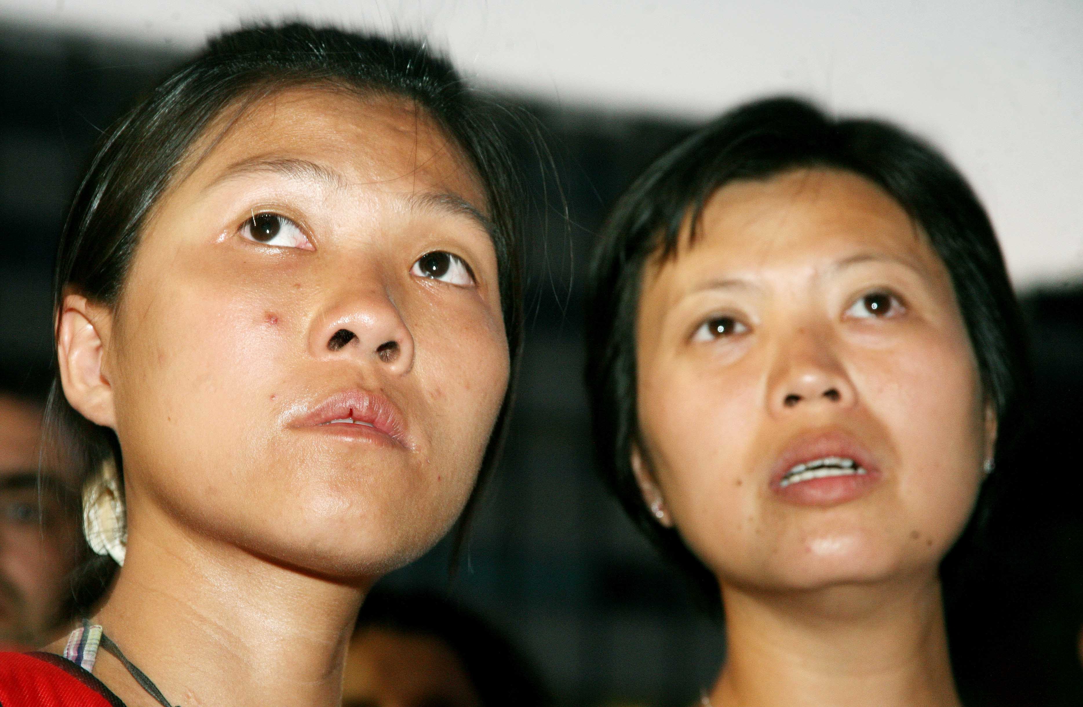 Κίνα: Kαταδικάστηκαν 12 “κτήνη” σε βαριές ποινές για εμπορία ανθρωπίνων οργάνων
