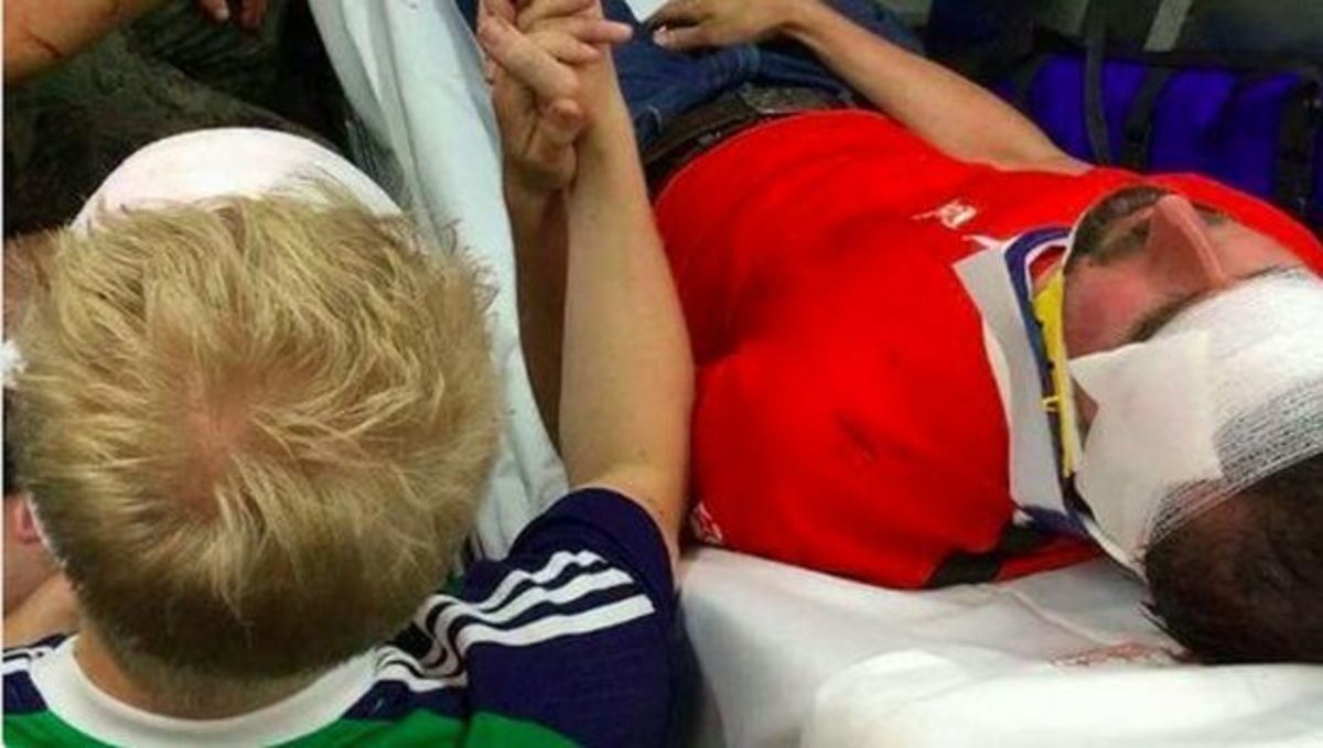 Euro 2016: Η συγκλονιστική φωτογραφία ενός Πολωνού μ’ έναν Βορειοϊρλανδό φίλαθλο!