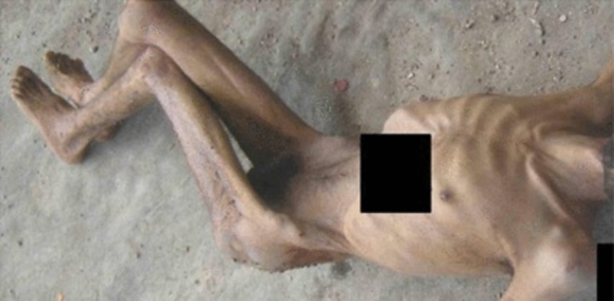 Συρία: “Πλαστές οι φωτογραφίες με τα βασανιστήρια και τις εκτελέσεις”