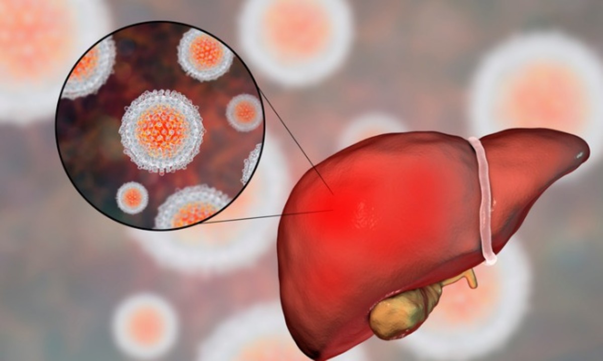 Πώς γίνεται να πεθάνεις από ηπατίτιδα Α – Τι συνέβη στην γυναίκα που έφαγε μολυσμένο ρόδι [vid]
