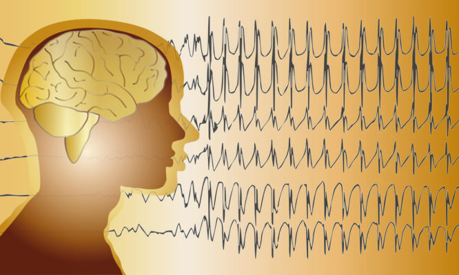 Επιληψία: Αίτια, συμπτώματα, παράγοντες κινδύνου και σωστή αντιμετώπιση