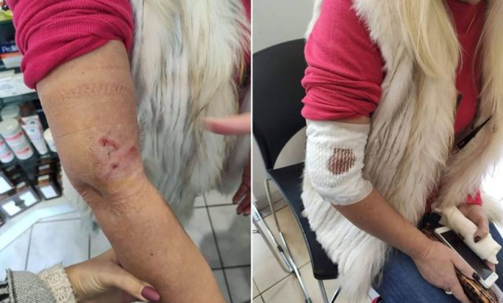 Λαμία: Επίθεση σκύλου σε γυναίκα! Την έριξε κάτω και τη δάγκωνε