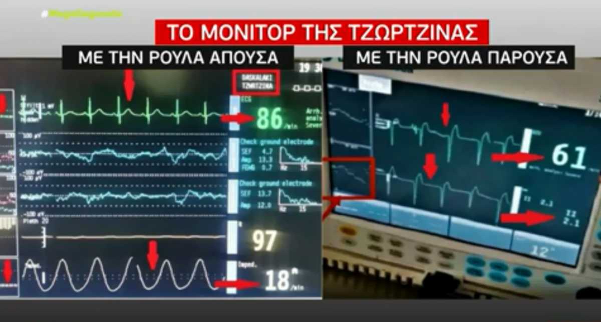 Ρούλα Πισπιρίγκου: Παρατεταμένη χορήγηση κεταμίνης ή δεύτερης ουσίας στη Τζωρτζίνα