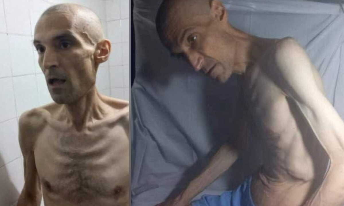Ιράν: Οργή από τις φωτογραφίες «σκελετωμένου» γιατρού που κάνει απεργία πείνας σε φυλακή