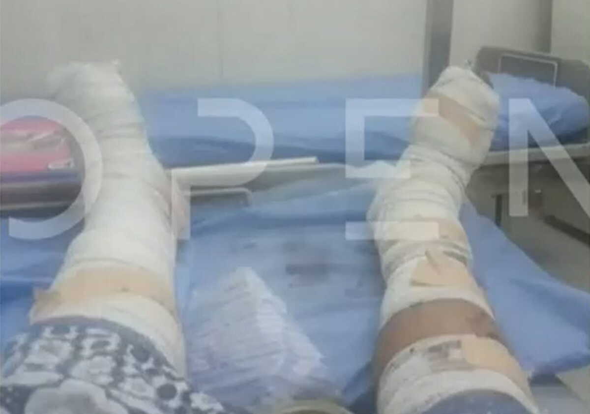 Σουδάν: Φωτογραφία ντοκουμέντο από τα τραύματα του Έλληνα – Οι γιατροί δεν μπορούν να φτάσουν στο νοσοκομείο