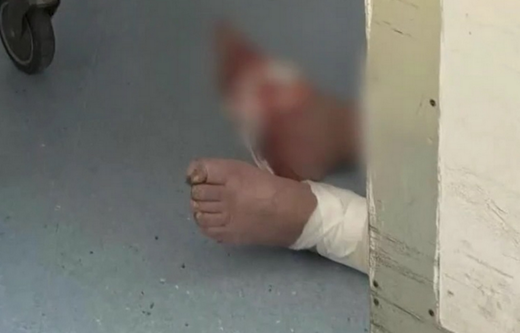 Θεσσαλονίκη: Ηλικιωμένος βρέθηκε αιμόφυρτος στο πάτωμα της κλινικής «Άγιος Παύλος» – Τι απαντάει το νοσοκομείο