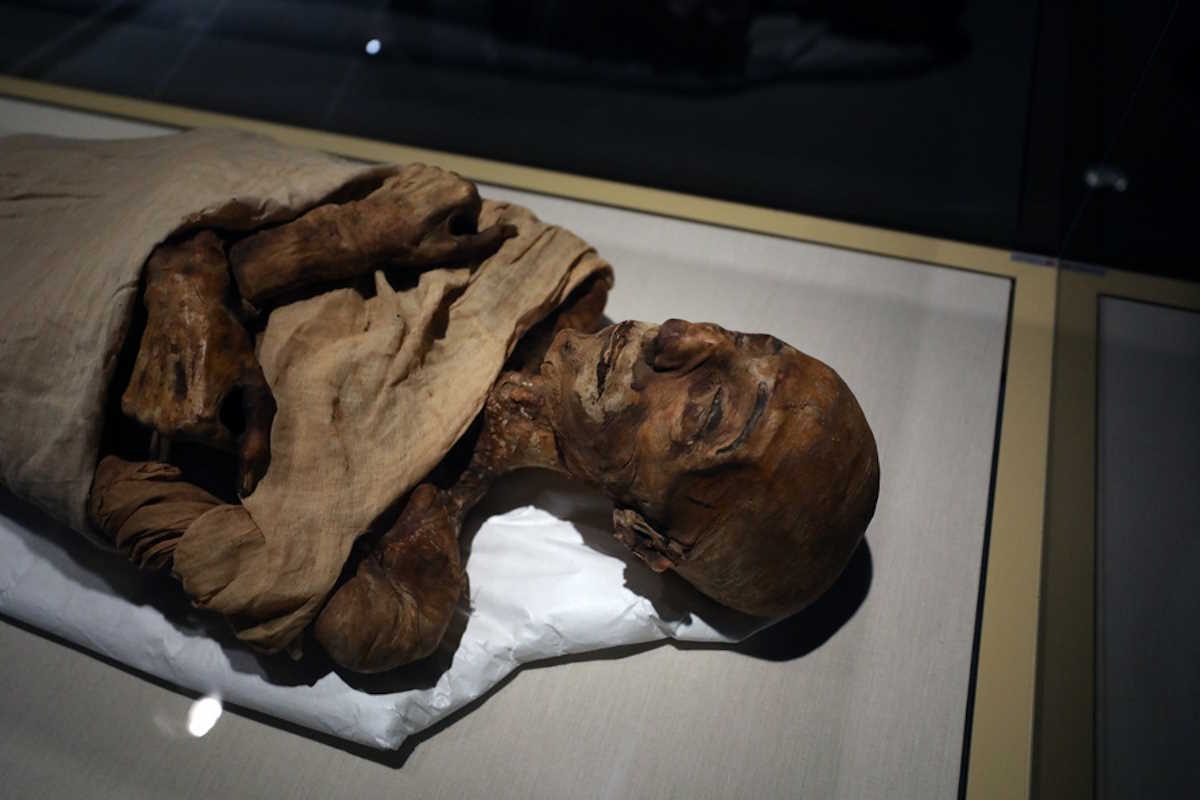 Αίγυπτος: «Η πρώτη φορά που η ανθρωπότητα χειρουργούσε καρκίνο» – Η επέμβαση στον εγκέφαλο πριν από 4.500 χρόνια