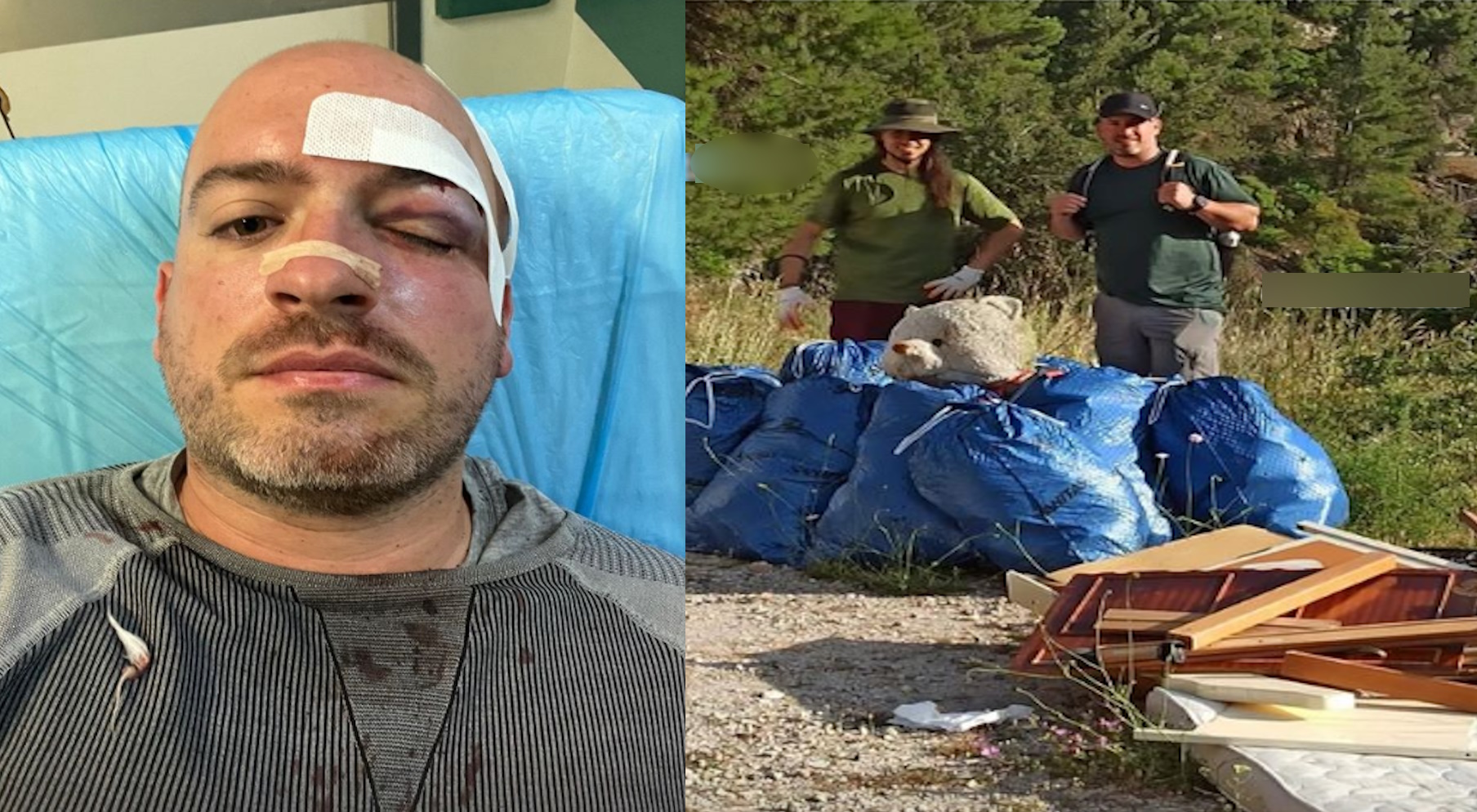Πάρνηθα: Φωτογραφίες σοκ με τραύματα των εθελοντών – Με τρεις μαχαιριές στην πλάτη και κάταγμα στη μύτη ο ένας