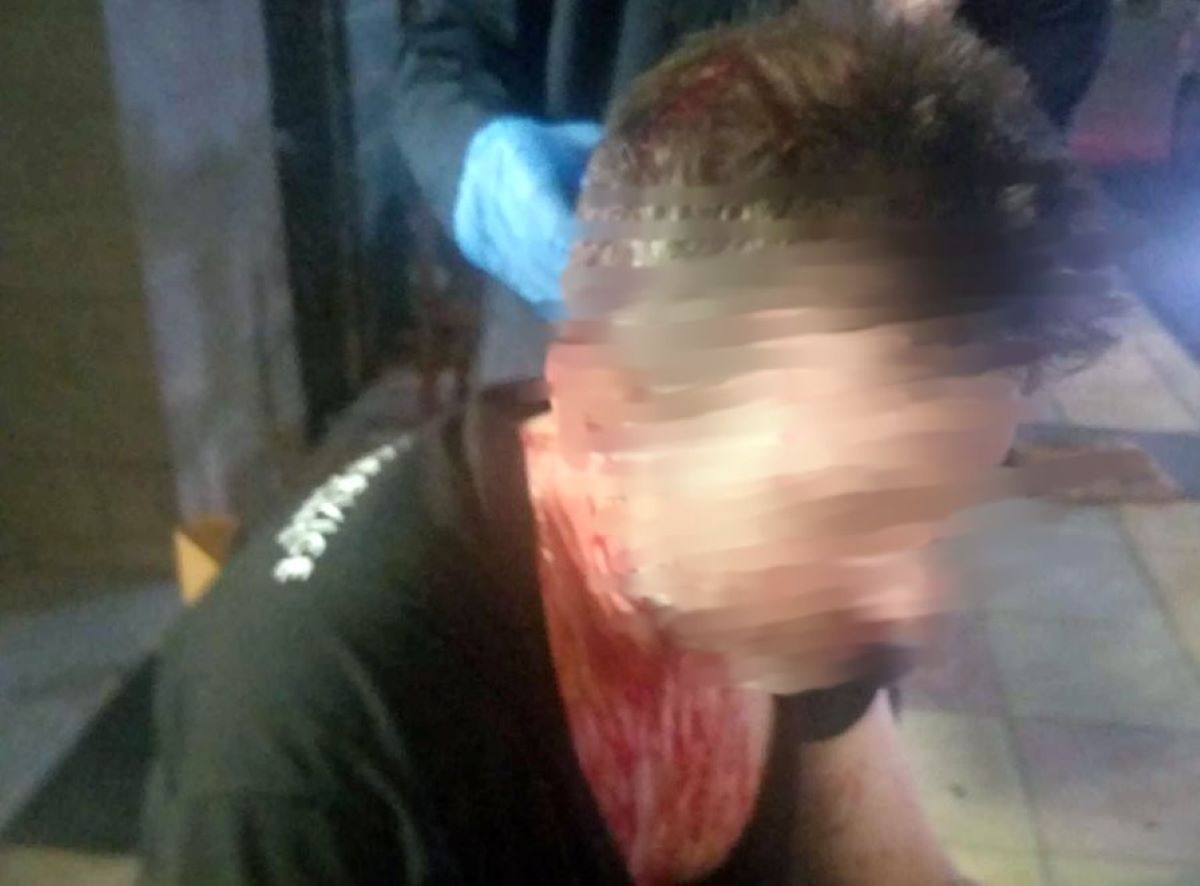 Αγρίνιο: «Μου άνοιξαν το κεφάλι, έχω 12 ράμματα», λέει ο εστιάτορας που ξυλοκοπήθηκε από πελάτες