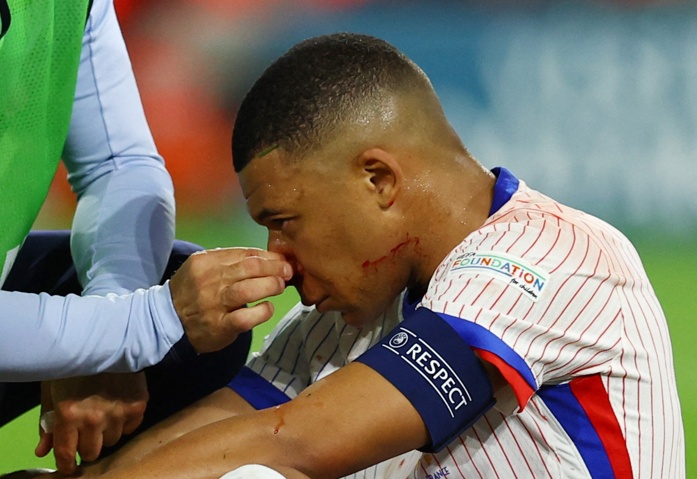 Soccer Football - Euro 2024 - Group D - Austria v France - Dusseldorf Arena, Dusseldorf, Germany - June 17, 2024 France's Kylian Mbappe reacts after sustaining an injury REUTERS