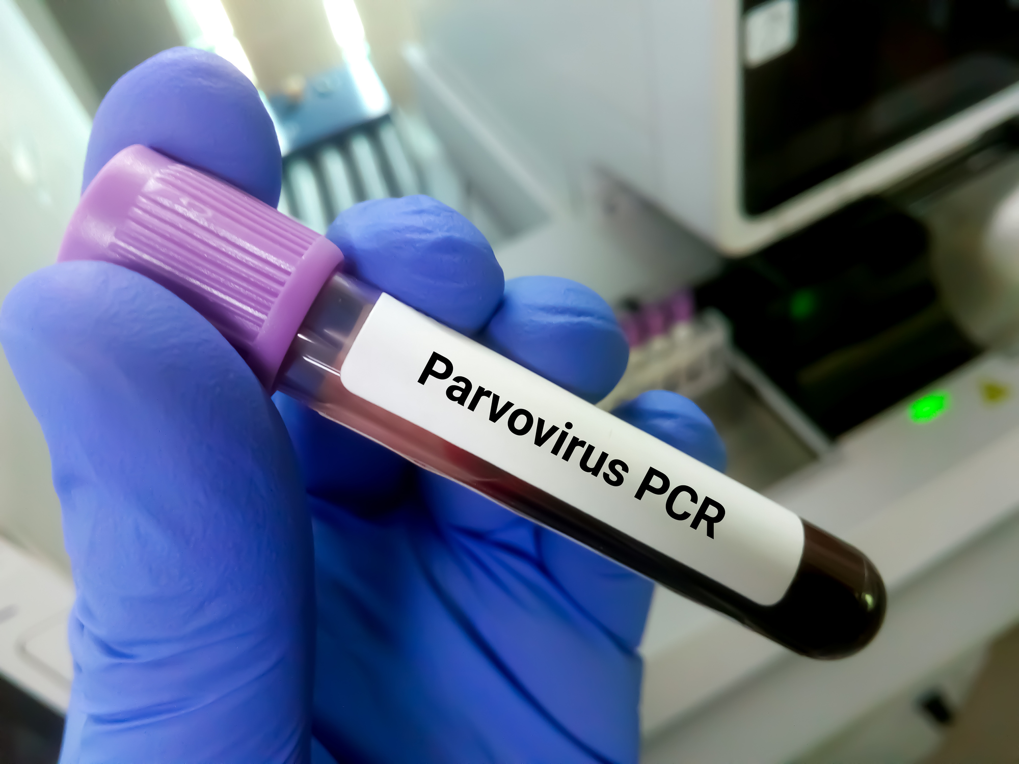 Παρβοϊός: Ποια συμπτώματα έχει, πως εντοπίζεται και πώς θεραπεύεται