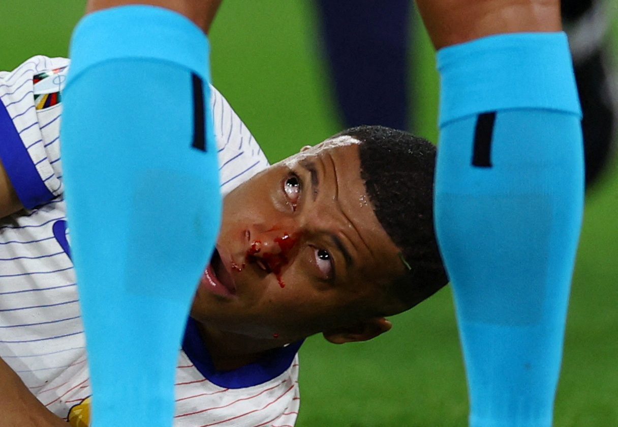 Soccer Football - Euro 2024 - Group D - Austria v France - Dusseldorf Arena, Dusseldorf, Germany - June 17, 2024 France's Kylian Mbappe reacts after sustaining an injury REUTERS