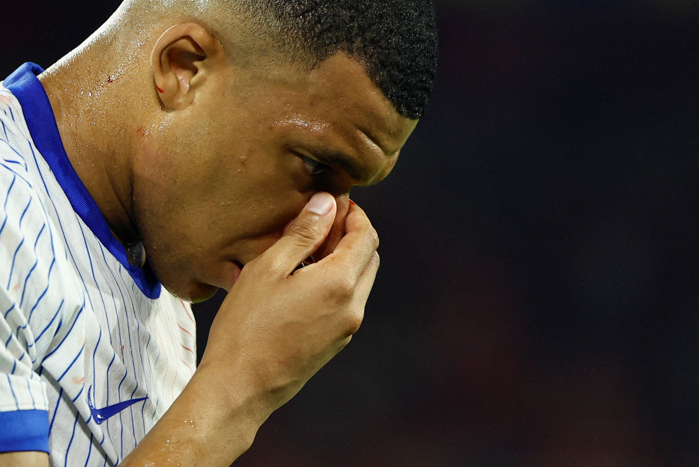 Soccer Football - Euro 2024 - Group D - Austria v France - Dusseldorf Arena, Dusseldorf, Germany - June 17, 2024 France's Kylian Mbappe holds his face after sustaining a facial injury REUTERS