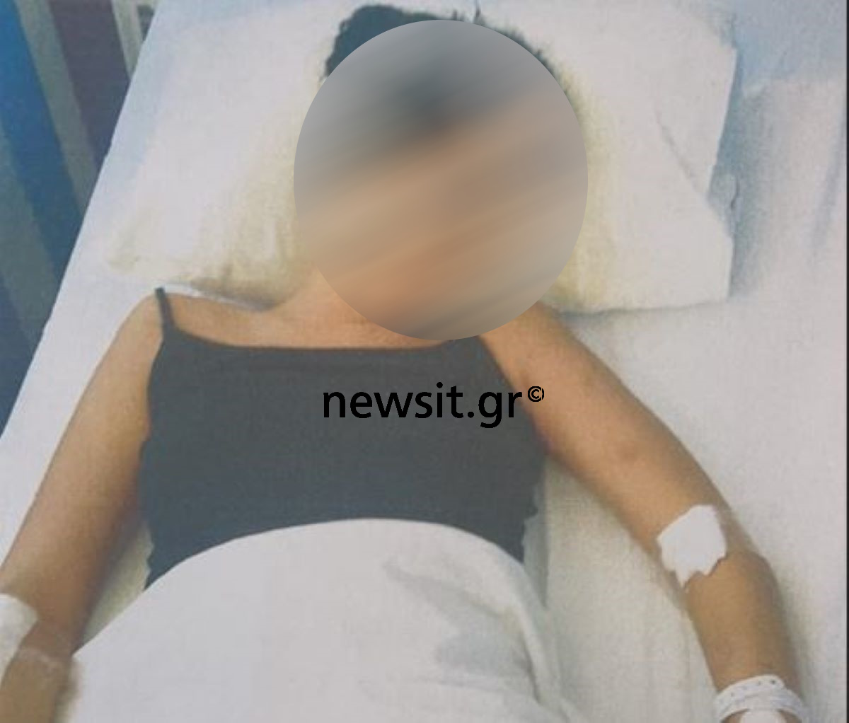 Σοκάρουν τα φωτογραφικά ντοκουμέντα από τον άγριο ξυλοδαρμό της 19χρονης στη Χαλκίδα: «Θα σε σκοτώσω» της φώναζε ο 23χρονος