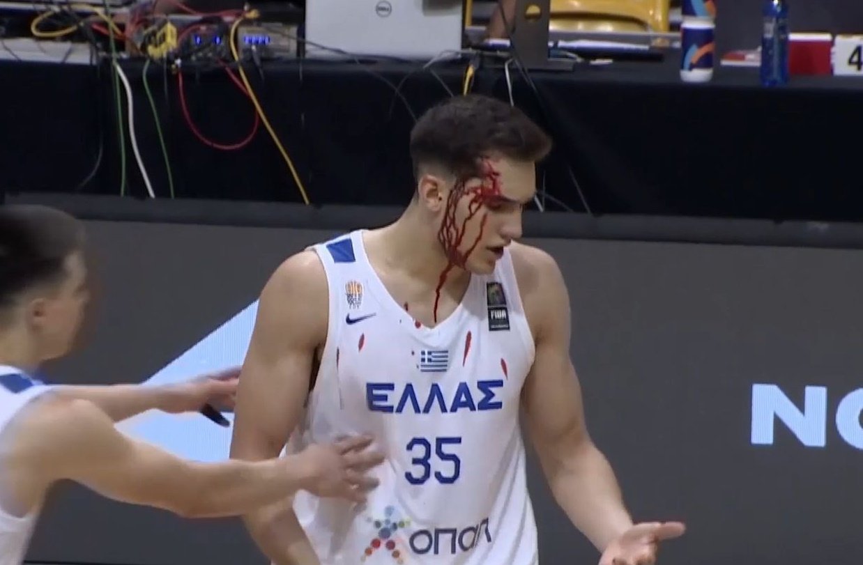 Ο Βαγγέλης Ζούγκρης «μάτωσε» τη φανέλα της Εθνικής Νέων Ανδρών και η FIBA τον χαρακτήρισε Έλληνα πολεμιστή