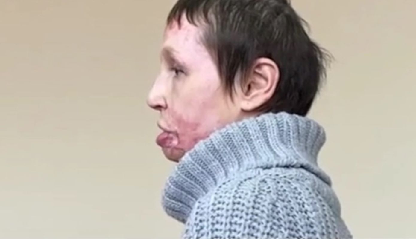 Ρωσία: Σταύρωσε με καρφιά την σύντροφό του σε σανίδες και της έβαλε φωτιά όταν του ζήτησε να χωρίσουν    