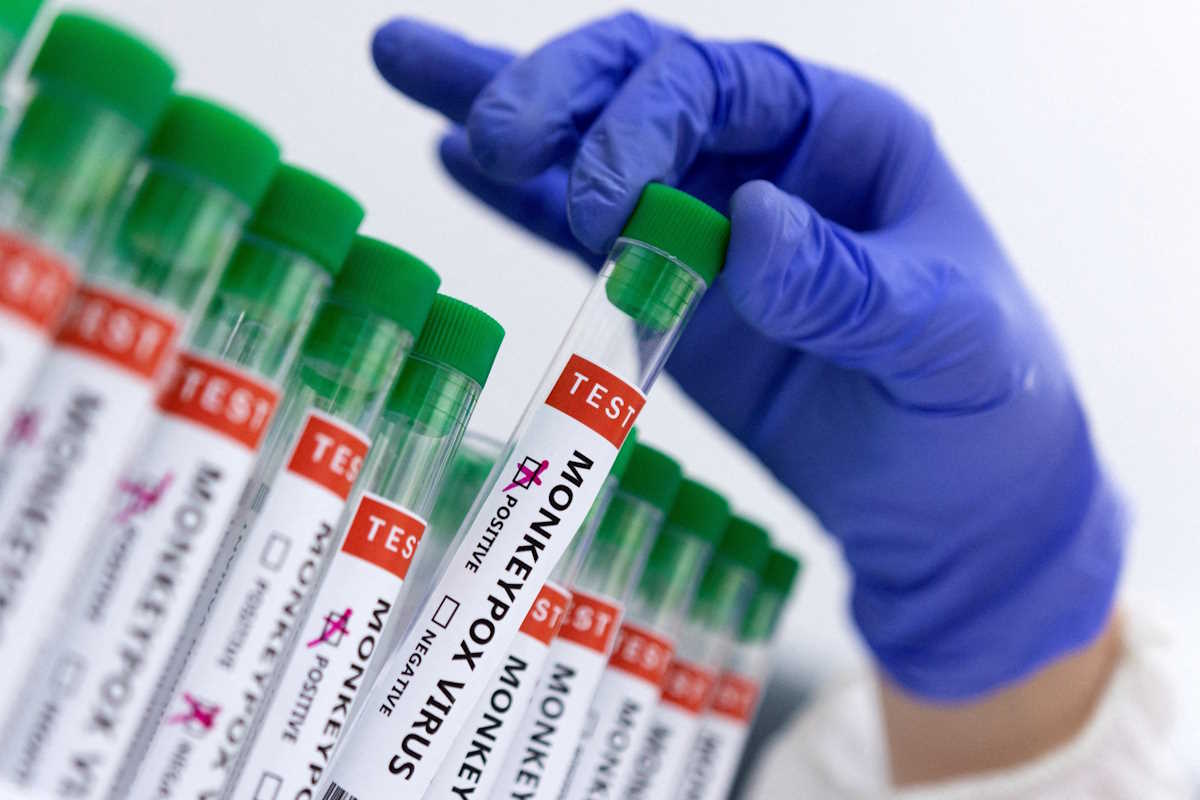 FILE PHOTO: FILE PHOTO: Test tubes labelled "Monkeypox virus positive and negative" are seen in this illustration taken May 23, 2022. REUTERS