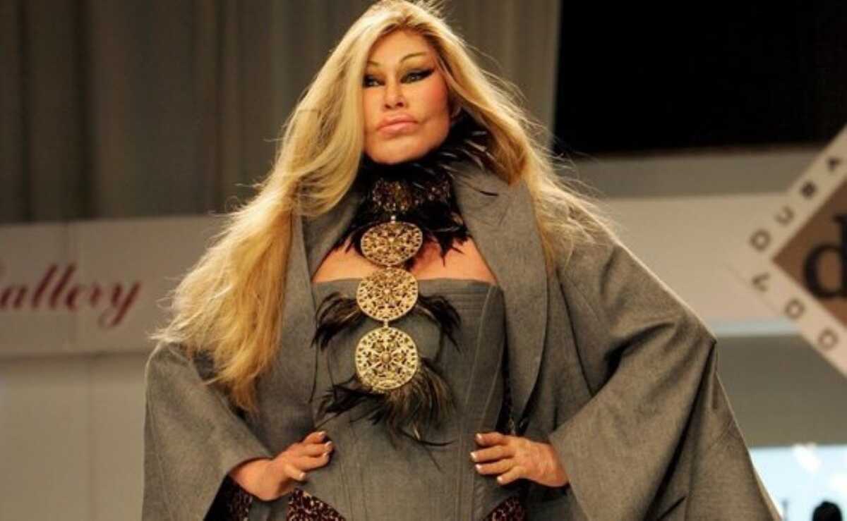 Jocelyne Wildenstein: Η «γυναίκα γάτα» λέει ότι δεν έχει κάνει ποτέ πλαστικές – «Μισώ τα botox»