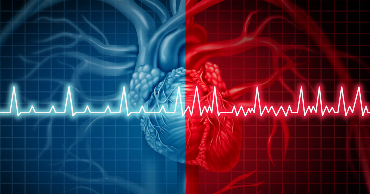 Holistic treatment of atrial fibrillation: It is a disease and not an arrhythmia