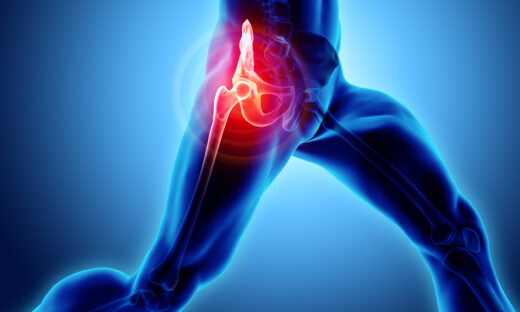 3D illustration, hip painful skeleton x-ray, medical concept