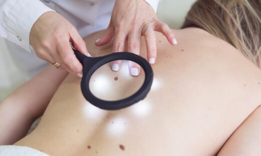 Female doctor examining moles of a patient with a magnifying glass - Buenos Aires - Argentina