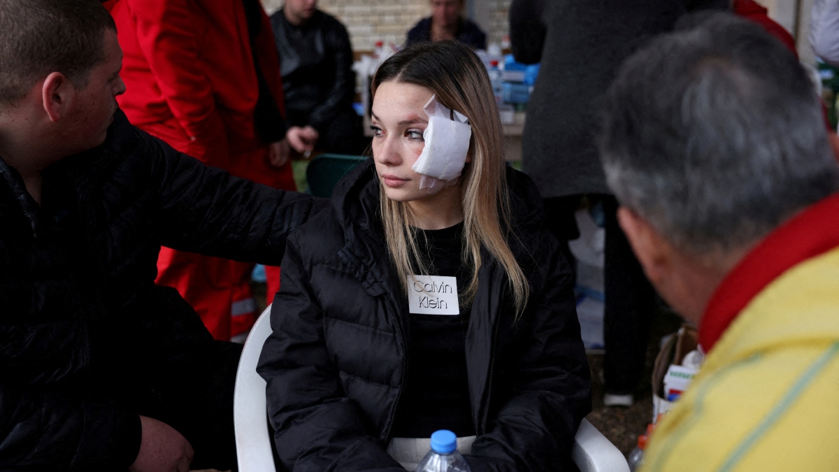 Μία νεαρή με τραύματα στο πρόσωπο